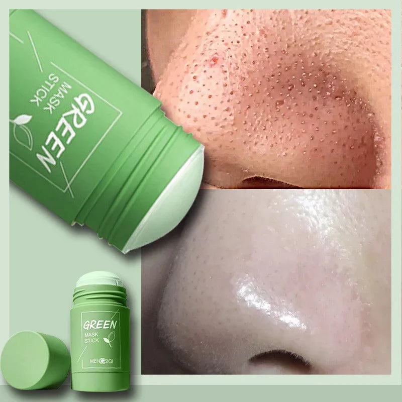 Green Tea Mask Stick for Blackheads & Oil Control – Solid Acne Treatment for All Skin Types