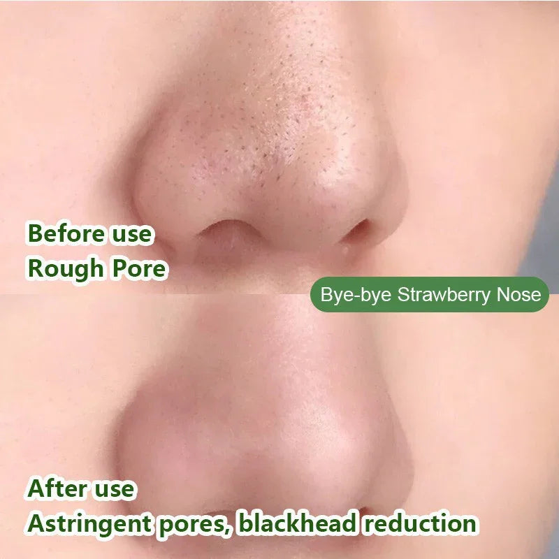 Green Tea Mask Stick for Blackheads & Oil Control – Solid Acne Treatment for All Skin Types