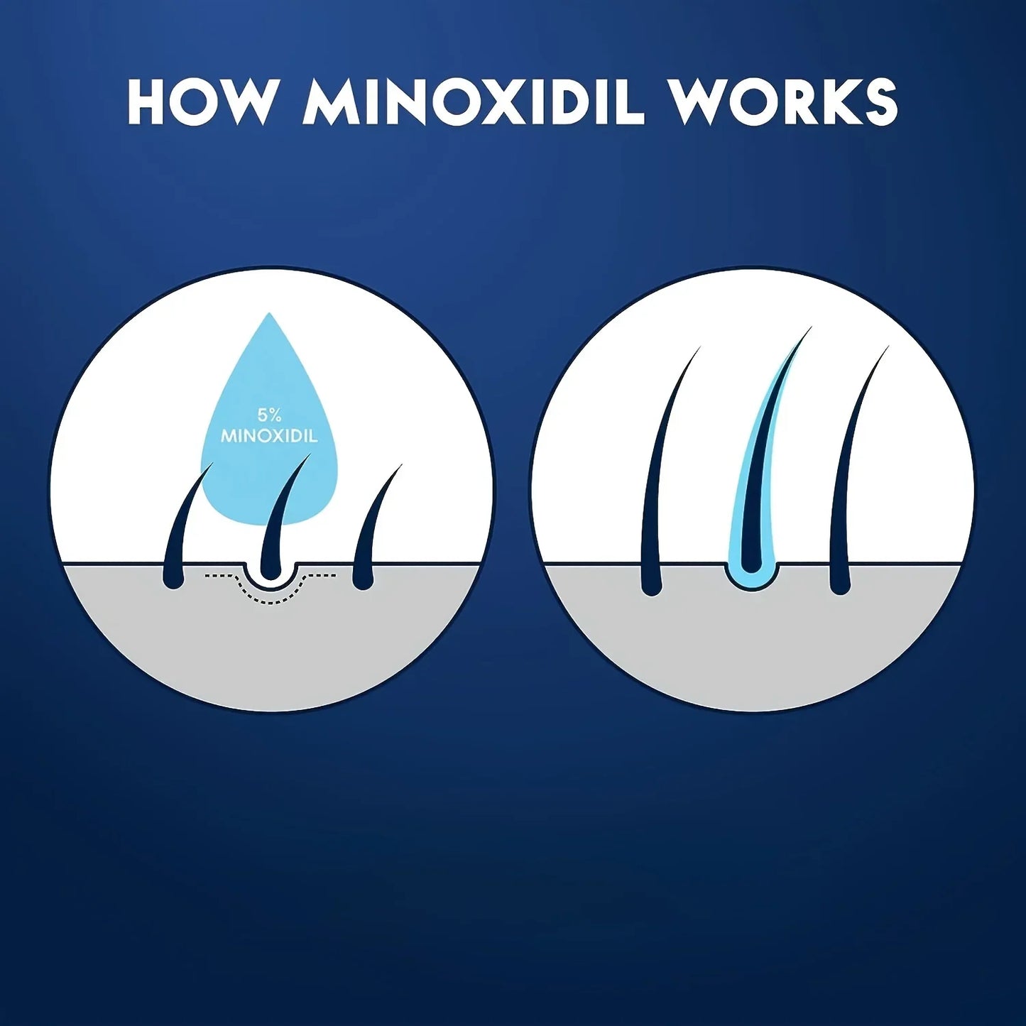 Hair Growth Serum – Minoxidil-Based for Thicker Hair