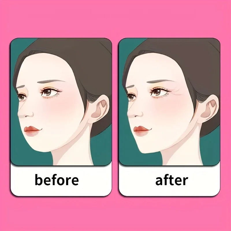 V-Line Chin Strap – Face Lifting Belt for Firm Jawline & Skin Tightening