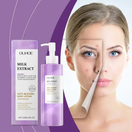 OUHOE Berry Scented Lotion lightens acne firming skin cleansing moisturizing and smoothing