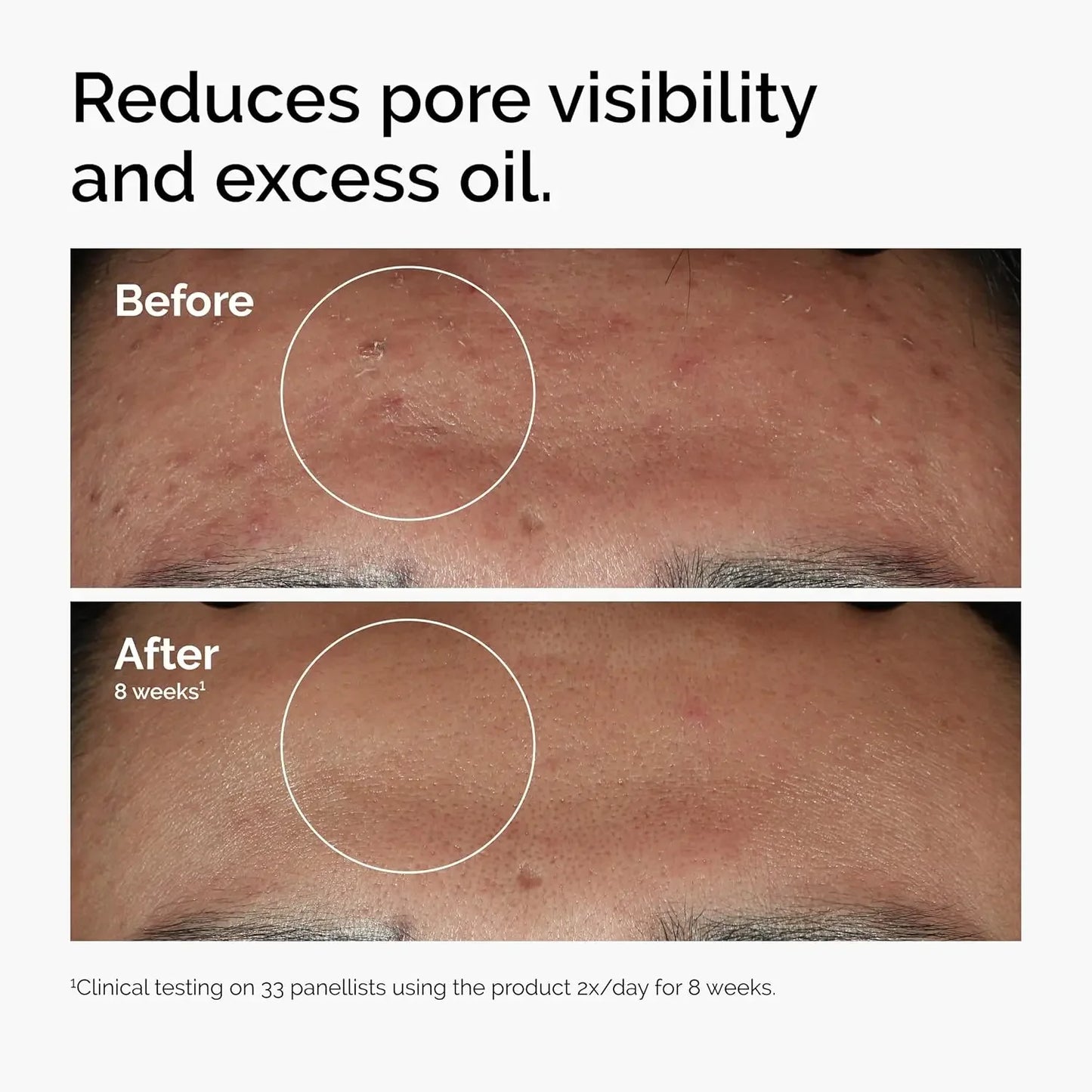 Odinary Skin Care Face Serum Private Label Moisturizing Nourishing Facial Essence Anti-aging AHA Essence