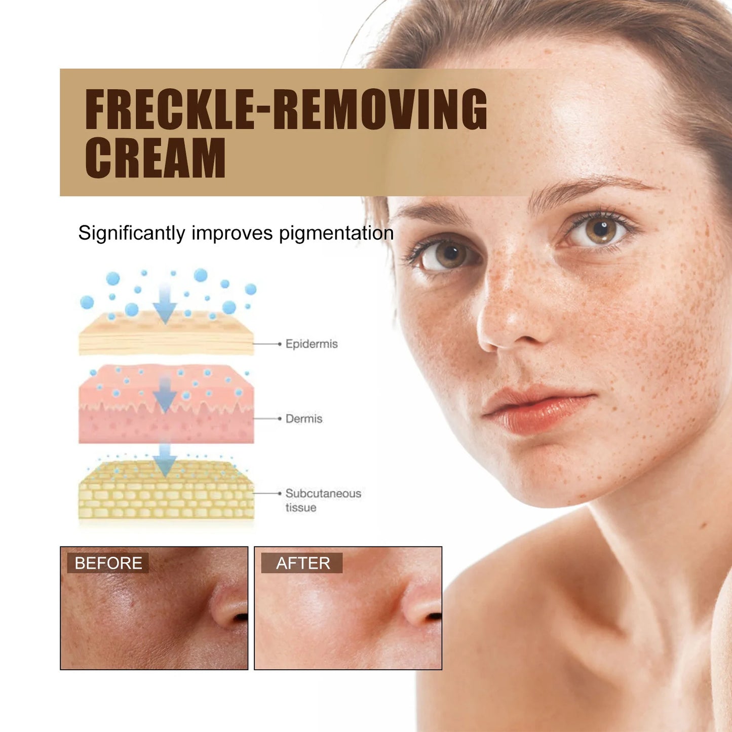 Freckle Whitening Cream Dark Spots Correction Fade Pigment Melasma Removal Blemish Brightening Deep Moisturizing Acne Treatment
