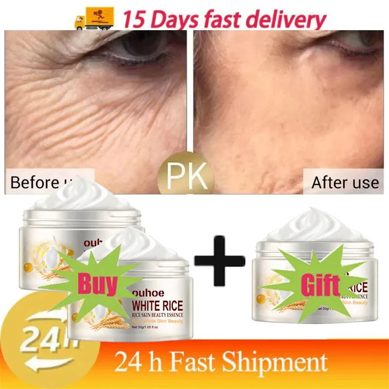 White Rice Whitening Facial Cream 30g Anti-Wrinkle Acne Treatment