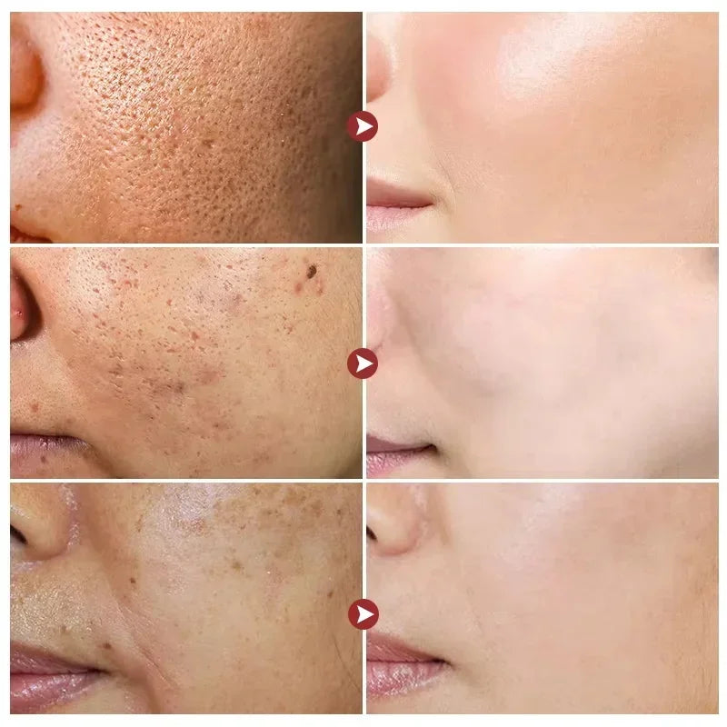 White Rice Whitening Facial Cream 30g Anti-Wrinkle Acne Treatment