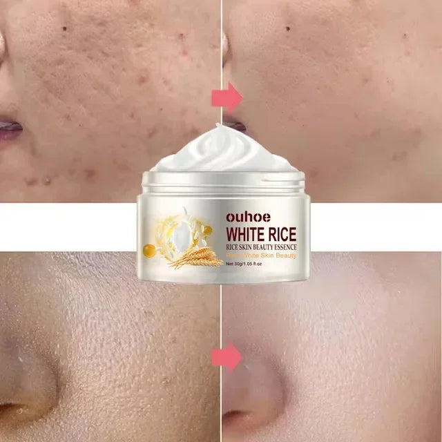 White Rice Whitening Facial Cream 30g Anti-Wrinkle Acne Treatment