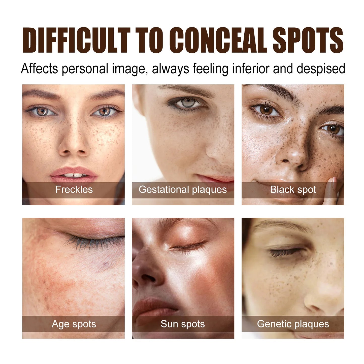 Freckle Whitening Cream Dark Spots Correction Fade Pigment Melasma Removal Blemish Brightening Deep Moisturizing Acne Treatment