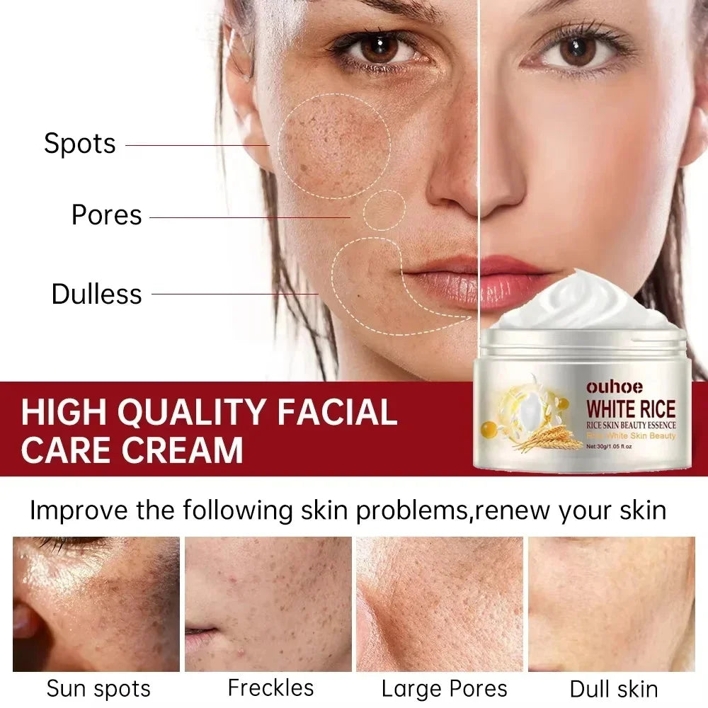 White Rice Whitening Facial Cream 30g Anti-Wrinkle Acne Treatment