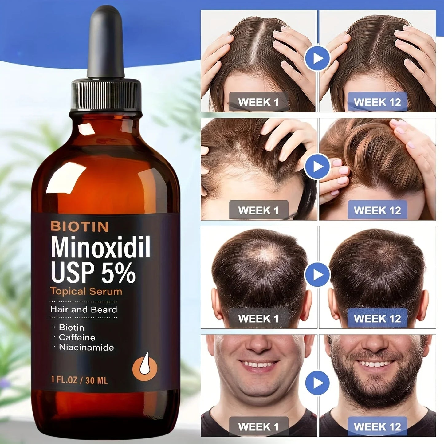 Hair Growth Serum – Minoxidil-Based for Thicker Hair