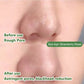 Green Tea Mask Stick for Blackheads & Oil Control – Solid Acne Treatment for All Skin Types