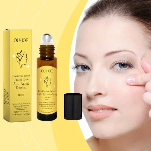 Eye Serum for Dark Circles & Puffiness – Organic Eye Treatment