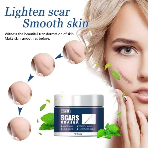 EELHOE  Surgery Repair Cold Compress Skin Scar Gel Balm