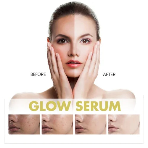 Hoygi Glow Serum  Moisturizing Whitening Skin To Reduce Facial Spots And Fine Lines