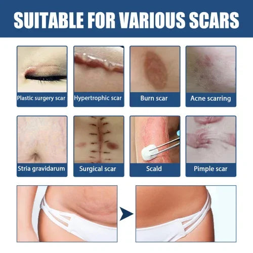 EELHOE  Surgery Repair Cold Compress Skin Scar Gel Balm