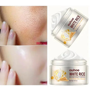 White Rice Whitening Facial Cream 30g Anti-Wrinkle Acne Treatment