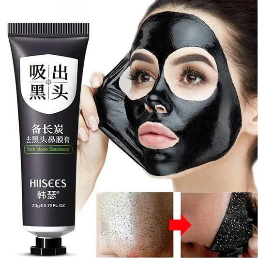 ouhoe Blackhead Remover Mask – Deep Cleansing, Pore Shrinking & Acne Treatment