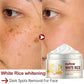 White Rice Whitening Facial Cream 30g Anti-Wrinkle Acne Treatment