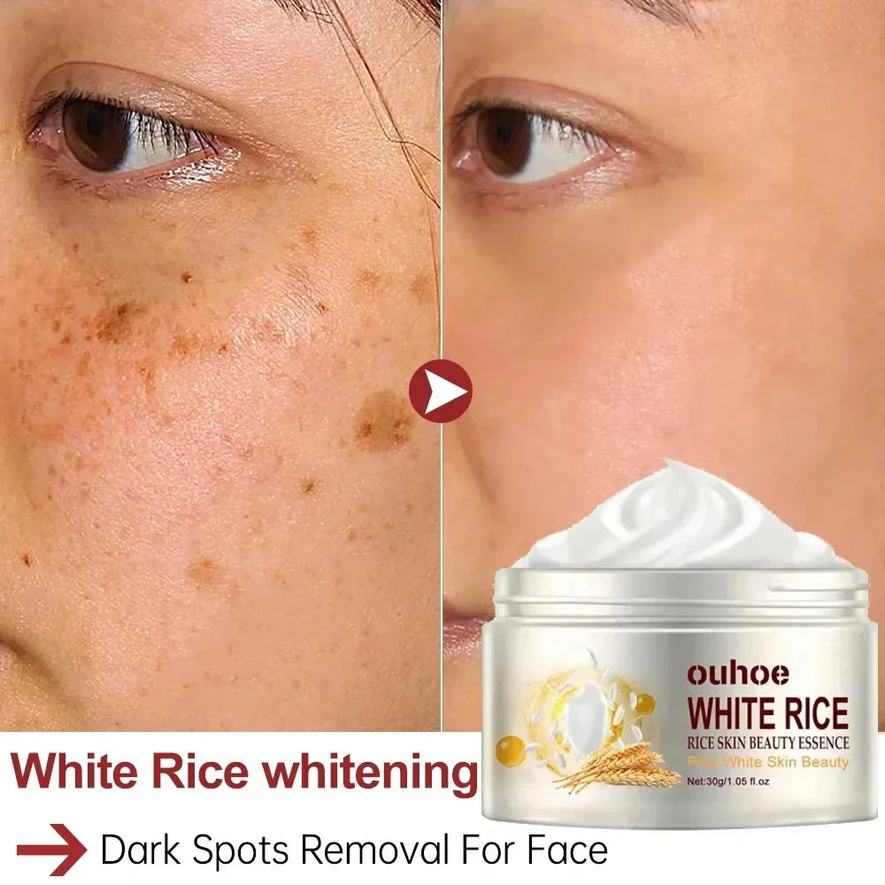 White Rice Whitening Facial Cream 30g Anti-Wrinkle Acne Treatment