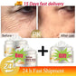 White Rice Whitening Facial Cream 30g Anti-Wrinkle Acne Treatment