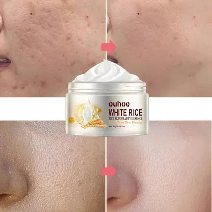 White Rice Whitening Facial Cream 30g Anti-Wrinkle Acne Treatment