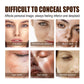 Freckle Whitening Cream Dark Spots Correction Fade Pigment Melasma Removal Blemish Brightening Deep Moisturizing Acne Treatment
