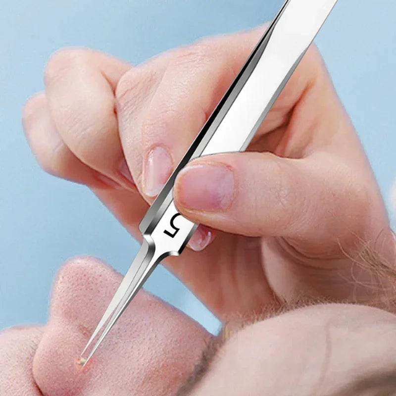 Ultra-Fine No. 5 German Cell Pimples Blackhead Clip
