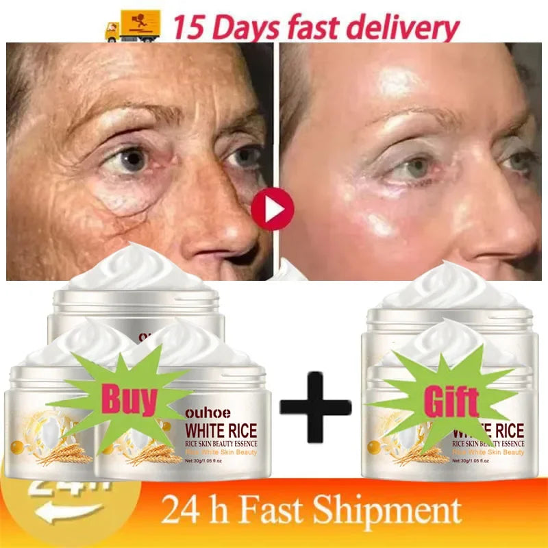 White Rice Whitening Facial Cream 30g Anti-Wrinkle Acne Treatment