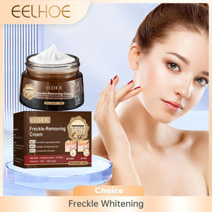 Freckle Whitening Cream Dark Spots Correction Fade Pigment Melasma Removal Blemish Brightening Deep Moisturizing Acne Treatment
